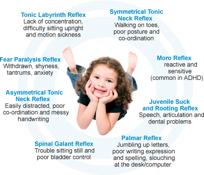 Courtesy of retainedneonatalreflexes.com.au