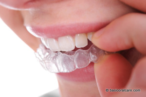 Soft-Splint-Dental-Guard