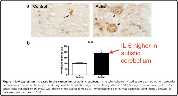 IL6 in cerebellum