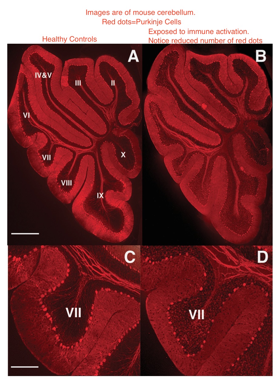 MIA-Purkinje cells